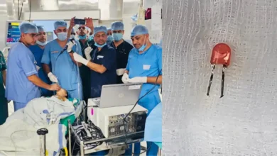 सेना के डॉक्टरों ने रचा इतिहास, 9 महीने के बच्चे के फेफड़े में फंसा LED बल्ब सुरक्षित निकाला